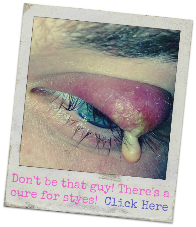 How to get rid of a stye fast?